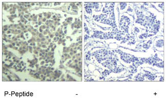 IHC - Phospho-C-Kit-Y936 Antibody AE1008d